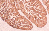 Chromogene für IHC