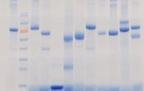 Protein-Elektrophorese