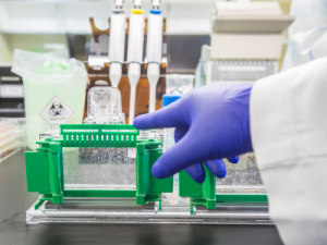 Western-Blot-Protokoll