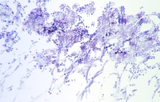 Mycology