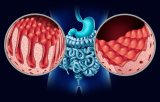 Enfermedades gastrointestinales