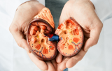 Células de enfermedad renal