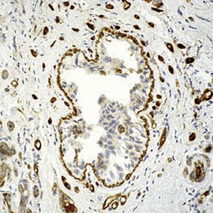 Custom service : Antibody validation in IHC on frozen tissue slides