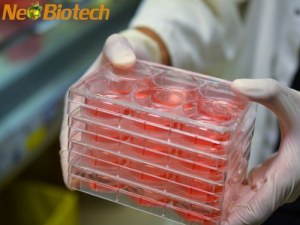 Soluciones de FBS de NeoBiotech: factores que influyen en el rendimiento