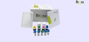 Save 30% OFF on Bioss Monoclonals for Immunohistochemistry