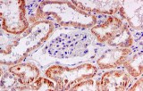 Produits pour l'immunohistochimie (IHC)