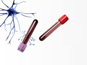 Campioni di origine umana per ricerche neurologiche