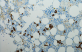 Reagentia voor immunokleuring