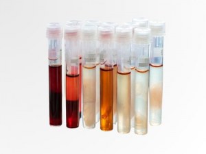 Van donor tot data: uw bron van menselijke monsters