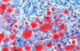 Lipiden