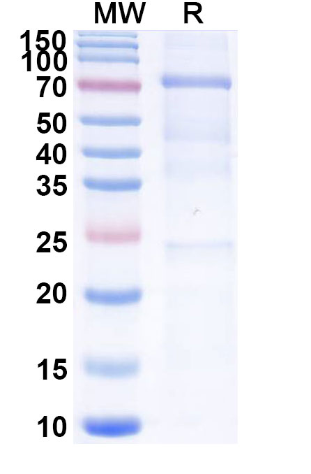 SDS-PAGE for Human IgM Isotype Control Antibody (SPE-7)