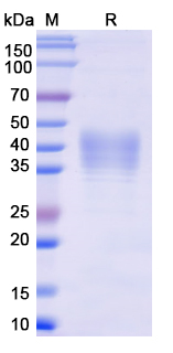 SDS-PAGE For Recombinant Monkeypox virus/MPXV E8L Protein