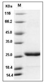Prolactin Protein, Mouse, Recombinant (His)