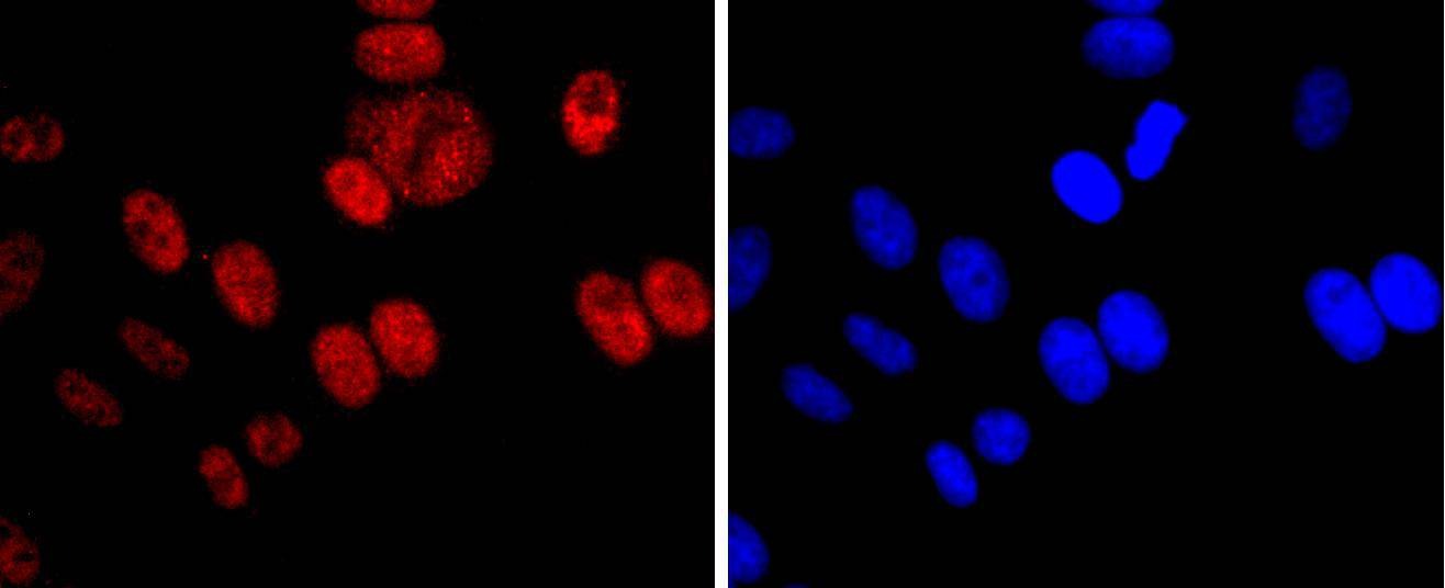 Anti-DNMT1 Antibody (5Y204)