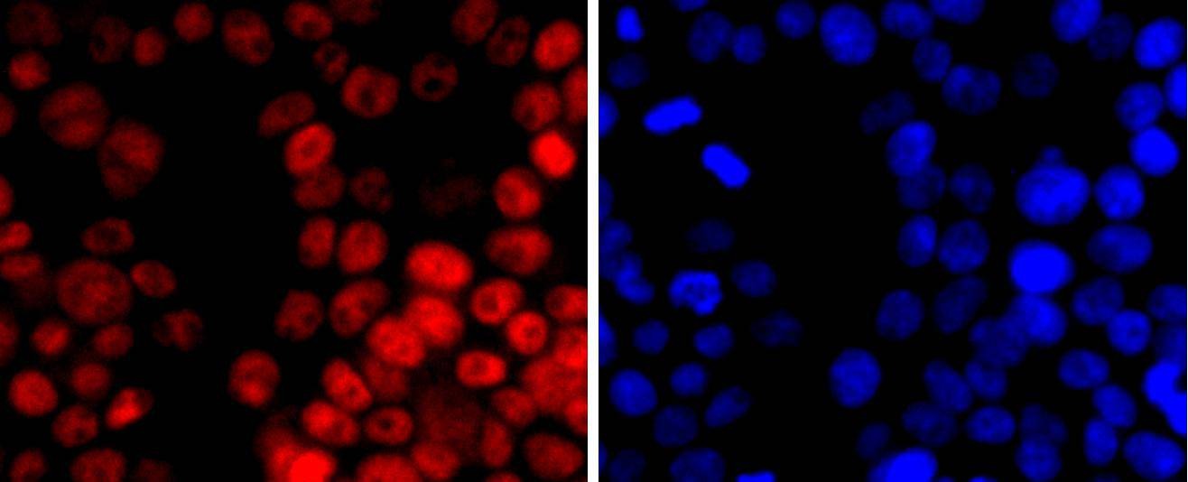 Anti-DNMT1 Antibody (5Y204)