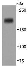 Anti-DNMT1 Antibody (5Y204)