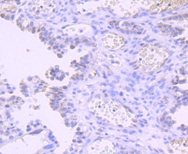 Anti-DNMT1 Antibody (5Y204)