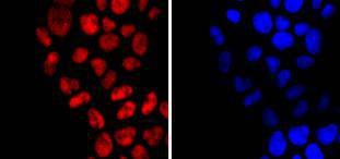 Anti-DNMT1 Antibody (5Y204)
