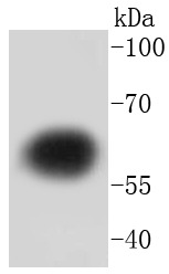 Anti-Tyrosine Hydroxylase Antibody (6W97)