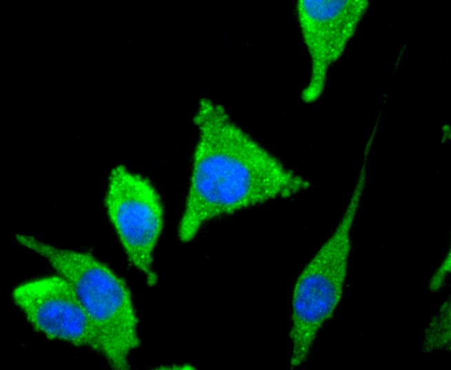 Anti-Tyrosine Hydroxylase Antibody (6W97)
