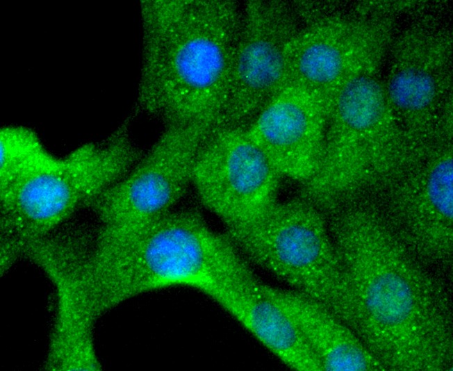 Anti-Tyrosine Hydroxylase Antibody (6W97)