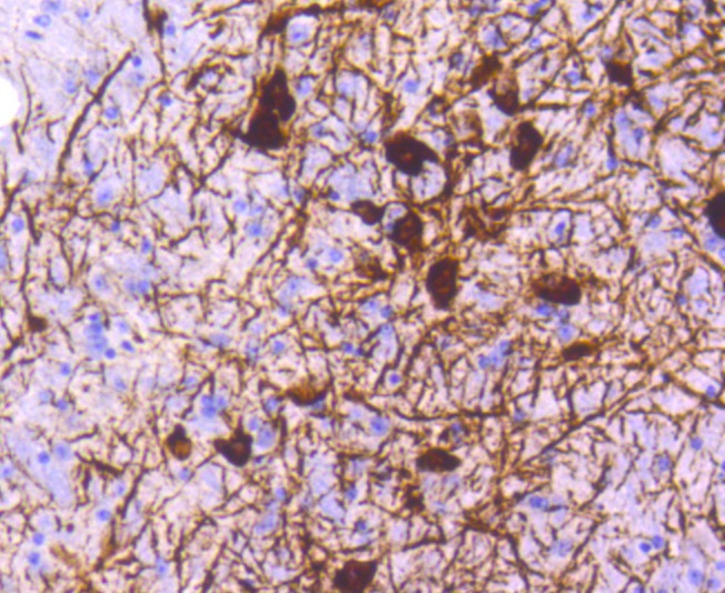 Anti-Tyrosine Hydroxylase Antibody (6W97)