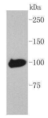 Anti-MMBP Antibody (5B968)