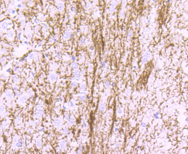 Anti-MBP Antibody (8X293)