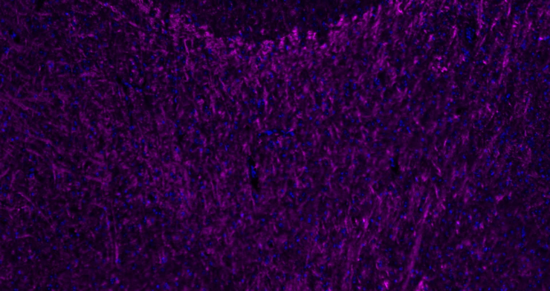 Anti-MBP Polyclonal Antibody