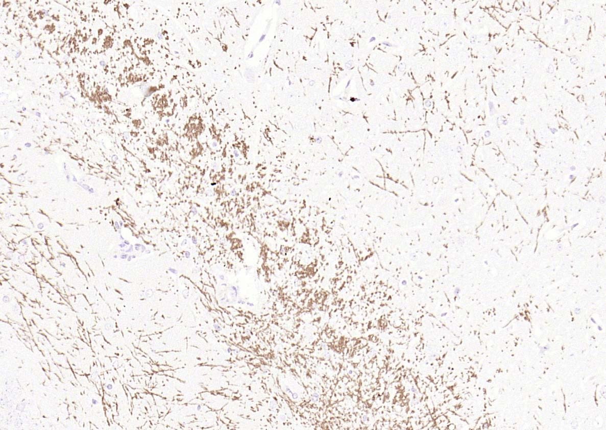 Anti-MBP Polyclonal Antibody 2
