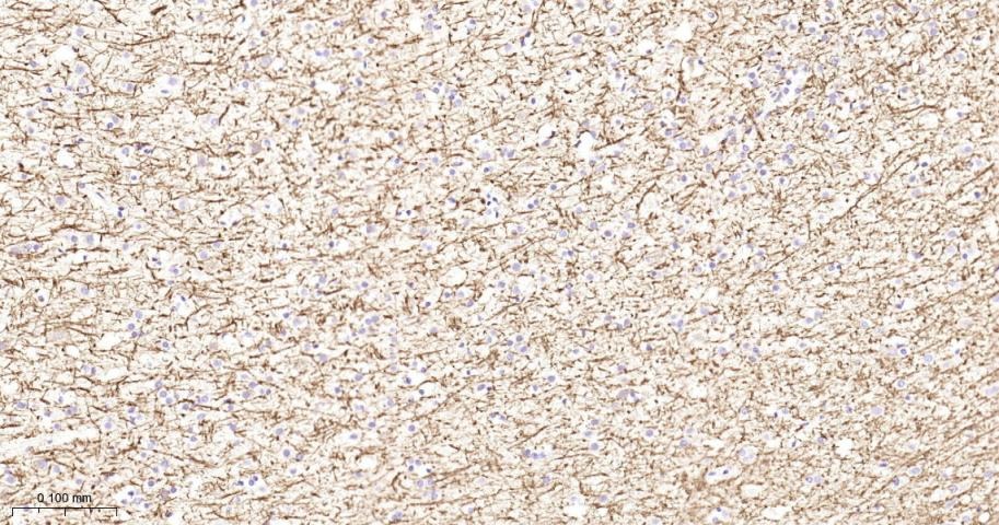 Anti-MBP Polyclonal Antibody 2