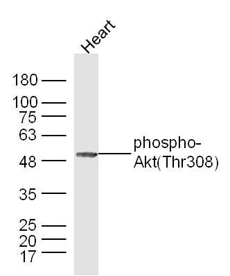 Anti-Phospho-Akt (Thr308) Polyclonal Antibody