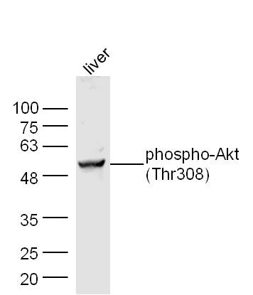 Anti-Phospho-Akt (Thr308) Polyclonal Antibody