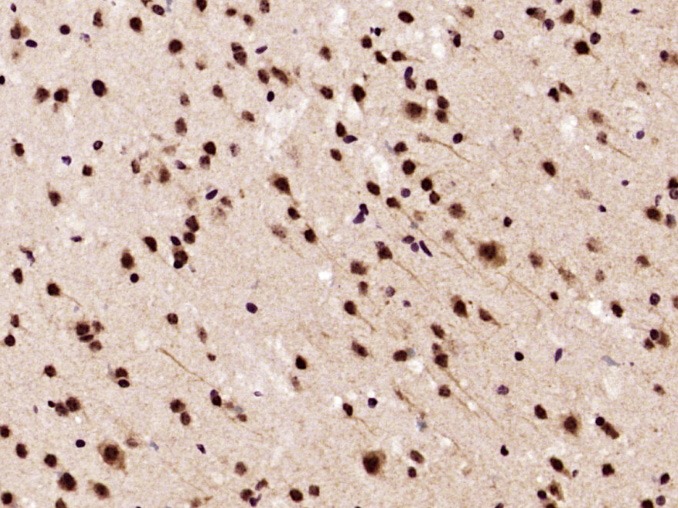 Anti-Phospho-Akt (Thr308) Polyclonal Antibody