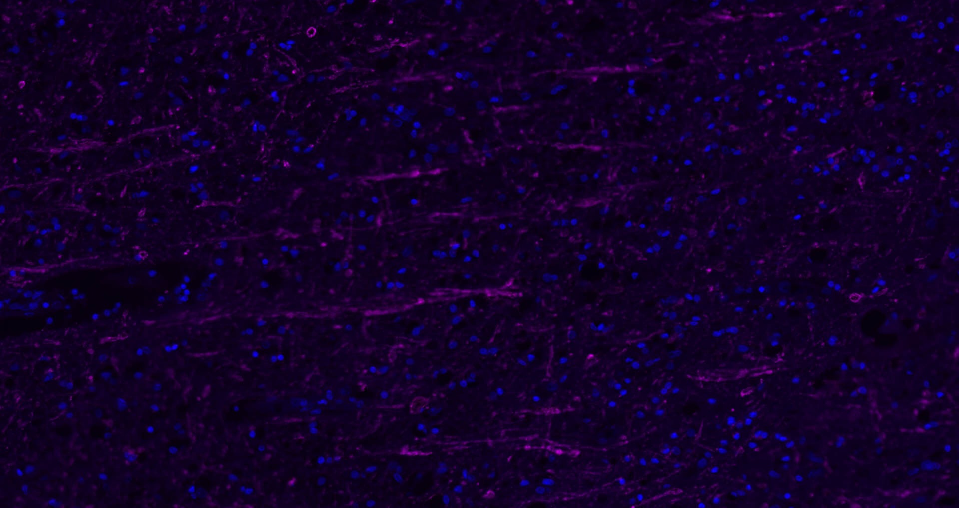 Anti-MBP Polyclonal Antibody 2