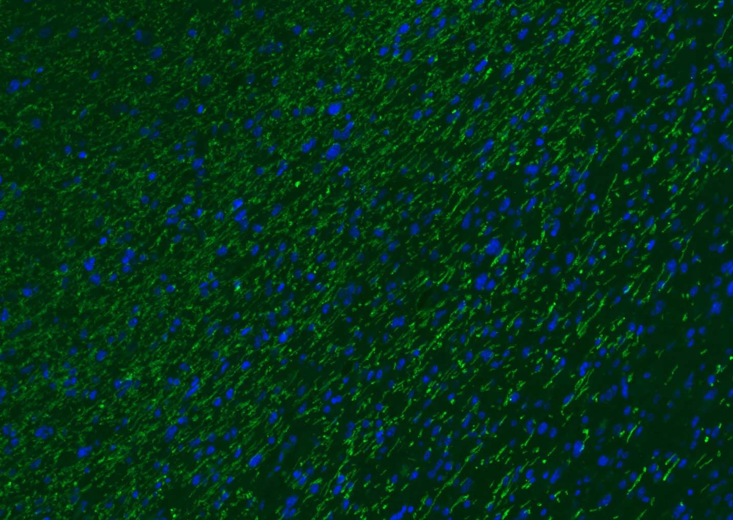 Anti-MBP Polyclonal Antibody 2
