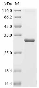 Human adenovirus B serotype 3 Hexon protein (His & Myc)