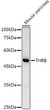 Western blot analysis of lysates from Mouse pancreas, using TR Beta 1/THRB Rabbit polyclonal antibody (STJ25847) at 1:1000 dilution. Secondary antibody: HRP Goat Anti-Rabbit IgG (H+L) (STJS000856) at 1:10000 dilution. Lysates/proteins: 25 Mu g per lane. Blocking buffer: 3% nonfat dry milk in TBST. Detection: ECL Basic Kit. Exposure time: 30s.