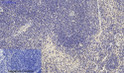 Immunohistochemical analysis of paraffin-embedded Mouse-spleen tissue. 1, Dnmt3b Polyclonal Antibody was diluted at 1:200 (4°C, overnight). 2, Sodium citrate pH 6.0 was used for antibody retrieval (>98°C, 20min). 3, Secondary antibody was diluted at 1:200 (room tempeRature, 30min). Negative control was used by secondary antibody only.
