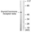 Western blot analysis of lysates from LOVO cells, using Thyroid Hormone Receptor beta Antibody. The lane on the right is blocked with the synthesized peptide.