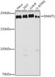 Western blot analysis of extracts of various cell lines, using DNMT1 antibody (STJ11102767) at 1:1000 dilution. Secondary antibody: HRP Goat Anti-rabbit IgG (H+L) (STJS000856) at 1:10000 dilution. Lysates/proteins: 25 Mu g per lane. Blocking buffer: 3% non-fat dry milk in TBST. Detection: ECL Basic Kit. Exposure time: 90s.