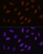 Immunofluorescence analysis of U2OS cells using TET3 Rabbit polyclonal antibody (STJ11100275) at dilution of 1:100. Secondary antibody: Cy3 Goat Anti-Rabbit IgG (H+L) at 1:500 dilution. Blue: DAPI for nuclear staining.