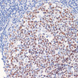 Immunohistochemistry analysis of DNMT1 in paraffin-embedded human tonsil using [KD Validated] DNMT1 Rabbit polyclonal antibody (STJ119140) at dilution of 1:200 (40x lens). Perform microwave antigen retrieval with 10 mM PBS buffer pH 7. 2 before commencing with immunohistochemistry staining protocol.