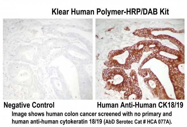 neoklear human