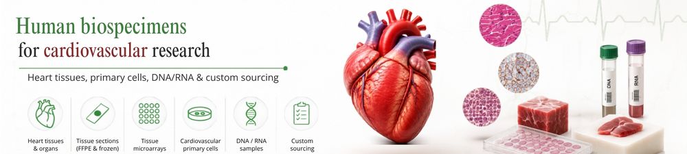 /upload/cardio-eg-tkeuj9.jpg
