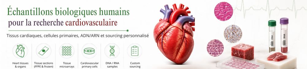/upload/cardio-fr-petxtp.jpg
