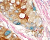 Neolink triple stain