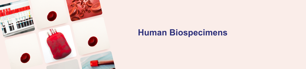 Lipide Nanodeeltjes Banner