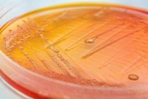 Protein production and purification in a prokaryotic system