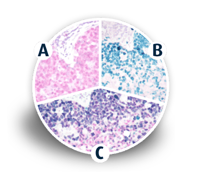 triple staining